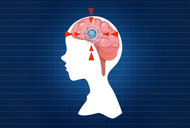Stroke-Ready Hospital